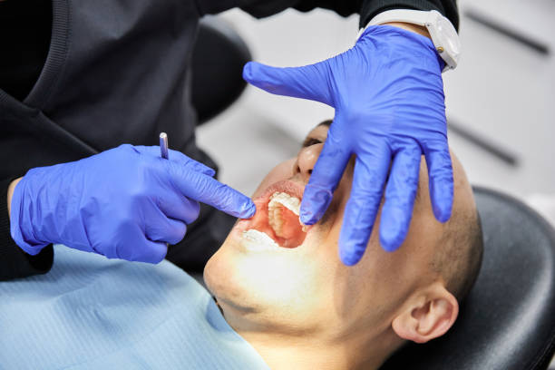 Best Teeth Whitening  in Plains, MT